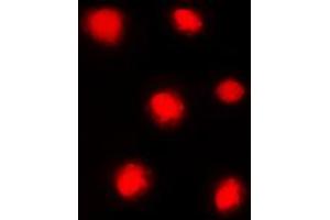 Immunofluorescent analysis of Histone H4 (pS47) staining in HeLa cells.