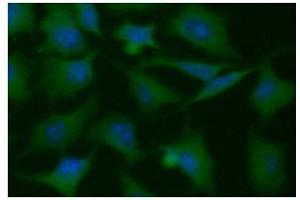 ICC/IF analysis of PGAM1 in HeLa cells line, stained with DAPI (Blue) for nucleus staining and monoclonal anti-human PGAM1 antibody (1:100) with goat anti-mouse IgG-Alexa fluor 488 conjugate (Green). (PGAM1 抗体)