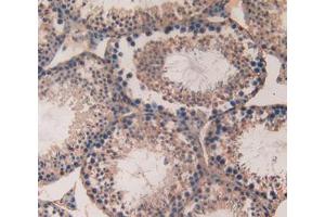 Used in DAB staining on fromalin fixed paraffin- embedded testis tissue