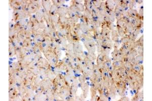 IHC testing of frozen mouse heart tissue with CPT1B antibody. (CPT1B 抗体)