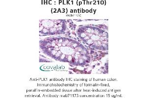 Image no. 1 for anti-Polo-Like Kinase 1 (PLK1) (pThr210) antibody (ABIN1724011) (PLK1 抗体  (pThr210))