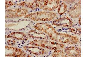 Immunohistochemistry of paraffin-embedded human kidney tissue using ABIN7159169 at dilution of 1:100 (Medium-Chain Specific Acyl-CoA Dehydrogenase, Mitochondrial (AA 26-421) 抗体)