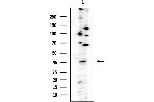 anti-LIM and Senescent Cell Antigen-Like Domains 2 (LIMS2) antibody