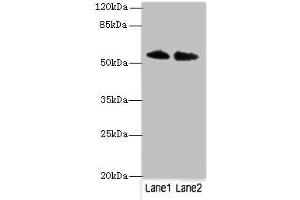 Western blot All lanes: TRIM55 antibody at 1 μg/mL Lane 1: Hela whole cell lysate Lane 2: Mouse liver tissue Secondary Goat polyclonal to rabbit IgG at 1/10000 dilution Predicted band size: 61, 51, 27 kDa Observed band size: 61 kDa (TRIM55 抗体  (AA 101-300))