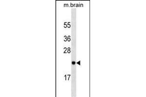 RAB23 Antibody (ABIN1539872 and ABIN2843843) western blot analysis in mouse brain tissue lysates (35 μg/lane). (RAB23 抗体)