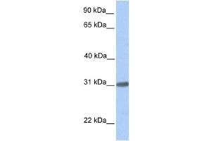 Western Blotting (WB) image for anti-Chromosome 7 Open Reading Frame 61 (C7orf61) antibody (ABIN2459744) (C7orf61 抗体)