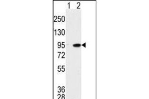 Western blot analysis of K (arrow) using K Antibody (C-term) (ABIN391782 and ABIN2841639). (MAK 抗体  (C-Term))
