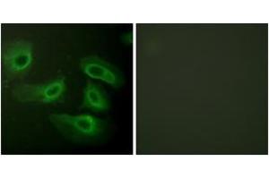 Immunofluorescence analysis of HeLa cells, using Caspase 9 (Ab-196) Antibody. (Caspase 9 抗体  (AA 162-211))