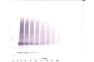 Image no. 1 for anti-Interleukin 17F (IL17F) antibody (ABIN465701) (IL17F 抗体)