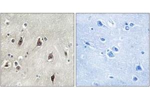 Immunohistochemistry analysis of paraffin-embedded human brain tissue, using p70 S6 Kinase (Ab-229) Antibody.