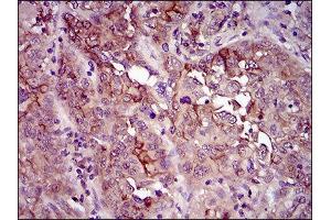 Immunohistochemistry (IHC) image for anti-CD33 (CD33) (AA 15-237) antibody (ABIN1845398) (CD33 抗体  (AA 15-237))