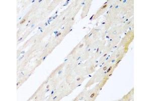 Immunohistochemistry of paraffin-embedded Rat heart using VCP Polyclonal Antibody at dilution of 1:200 (40x lens). (VCP 抗体)