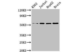 Western Blot Positive WB detected in: K562 whole cell lysate, Jurkat whole cell lysate, HepG2 whole cell lysate, Mouse brain tissue All lanes: SLC16A8 antibody at 3 μg/mL Secondary Goat polyclonal to rabbit IgG at 1/50000 dilution Predicted band size: 53 kDa Observed band size: 53 kDa (MCT3 抗体  (AA 432-504))