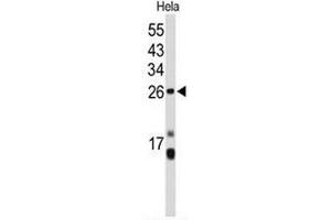 Western blot analysis of CENPH Antibody (Center) in Hela cell line lysates (35µg/lane). (CENPH 抗体  (Middle Region))