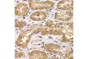 Immunohistochemistry of paraffin-embedded human kidney using ANAPC5 antibody at dilution of 1:100 (x400 lens). (ANAPC5 抗体)