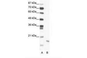 Image no. 1 for anti-Second Mitochondria-Derived Activator of Caspase (DIABLO) (C-Term) antibody (ABIN203000) (DIABLO 抗体  (C-Term))