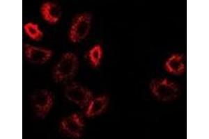 Immunofluorescent analysis of ATF6 staining in A549 cells. (ATF6 抗体)