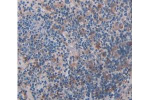 Used in DAB staining on fromalin fixed paraffin- embedded Kidney tissue (ADRBK2 抗体  (AA 191-453))