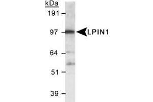 Western blot analysis of LPIN1 in 3T3-L1 lysate using LPIN1 polyclonal antibody . (Lipin 1 抗体  (AA 500-600))