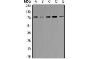 Western blot analysis of NRG1 expression in HEK293T (A), AD293 (B), Hela (C), HepG2 (D), 22RV1 (E) whole cell lysates. (Neuregulin 1 抗体  (N-Term))