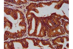 IHC image of ABIN7158397 diluted at 1:200 and staining in paraffin-embedded human prostate tissue performed on a Leica BondTM system. (EVC2 抗体  (AA 30-199))