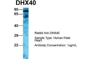 Host: Rabbit  Target Name: DHX40  Sample Tissue: Human Fetal Heart  Antibody Dilution: 1. (DEAH (Asp-Glu-Ala-His) Box Polypeptide 40 (DHX40) (C-Term) 抗体)