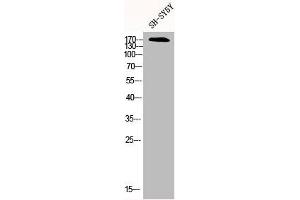 Western Blot analysis of SH-SY5Y cells using CFTR Polyclonal Antibody