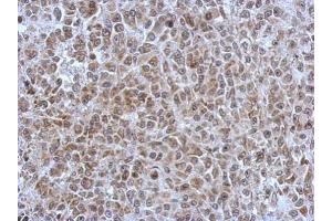 IHC-P Image Immunohistochemical analysis of paraffin-embedded HBL435 xenograft, using POM121, antibody at 1:500 dilution. (POM121 抗体  (N-Term))
