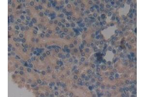Detection of a1BG in Rat Kidney Tissue using Monoclonal Antibody to Alpha-1-B-Glycoprotein (a1BG) (A1BG 抗体  (AA 220-415))