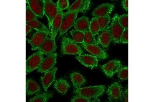 Immunofluorescence (IF) image for anti-Moesin (MSN) antibody (ABIN6940082)