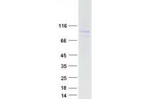 Western Blotting (WB) image for Mitogen-Activated Protein Kinase Kinase Kinase MLT (ZAK) (Transcript Variant 1) protein (Myc-DYKDDDDK Tag) (ABIN2726111)