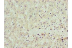 Immunohistochemistry of paraffin-embedded human liver tissue using ABIN7169907 at dilution of 1:100 (Sclt1 抗体  (AA 1-79))