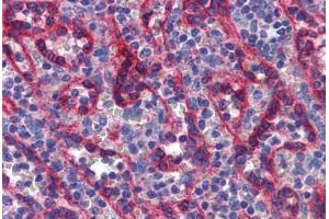 Human Spleen: Formalin-Fixed, Paraffin-Embedded (FFPE) (T-Box 18 抗体  (AA 421-470))