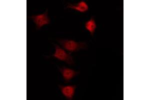 ABIN6266457 staining K562 by IF/ICC. (ENOS 抗体  (pSer615))
