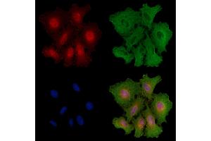 ABIN6259071 and ABIN6273601 staining  cells by IF/ICC.