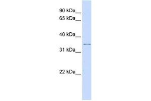 KCNRG antibody used at 1 ug/ml to detect target protein.