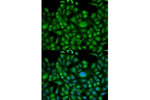 Immunofluorescence analysis of U2OS cell using HSPA1L antibody. (HSPA1L 抗体)