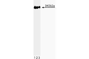 Western blot analysis of 53BP1 on a HeLa lysate. (TP53BP1 抗体  (AA 149-259))