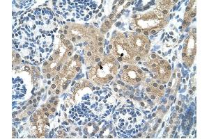 GPT antibody was used for immunohistochemistry at a concentration of 4-8 ug/ml to stain Epithelial cells of renal tubule (arrows) in Human Kidney. (ALT 抗体)