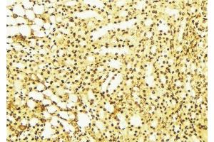 ABIN6275841 at 1/100 staining Mouse liver tissue by IHC-P. (DRAK2 抗体  (C-Term))