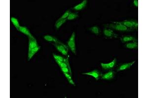 Immunofluorescent analysis of Hela cells using ABIN7146536 at dilution of 1:100 and Alexa Fluor 488-congugated AffiniPure Goat Anti-Rabbit IgG(H+L) (Calpain 14 抗体  (AA 68-366))