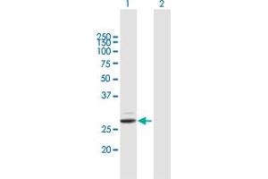 Western Blot analysis of PRSS2 expression in transfected 293T cell line by PRSS2 MaxPab polyclonal antibody. (PRSS2 抗体  (AA 1-239))