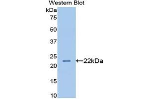 Detection of Recombinant APOB, Rat using Monoclonal Antibody to Apolipoprotein B (APOB) (APOB 抗体  (AA 2747-2913))