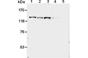 Western blot analysis of SREBP-2 expression in HEp-2 , MCF-7 , LNCap , HT1080 and ZR-75-1  using AM26563AF-N