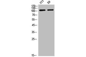 Western Blot analysis of NIH-3T3 KB cells using CD21 Polyclonal Antibody (CD21 抗体  (Internal Region))