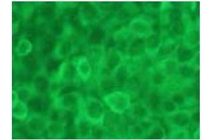 Immunofluorescence (IF) image for anti-Caspase 12 (Gene/pseudogene) (CASP12) (AA 95-318), (N-Term) antibody (ABIN567795) (Caspase 12 抗体  (N-Term))