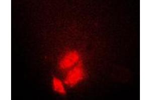 Immunofluorescent analysis of TSC22 staining in HeLa cells. (TSC22D1 抗体  (C-Term))