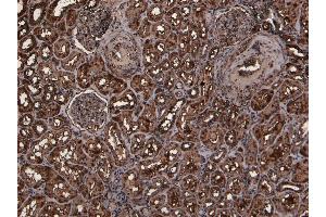 Immunohistochemistry (IHC) image for anti-Transmembrane Protease, serine 2 (TMPRSS2) (Internal Region) antibody (ABIN570926)