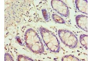 Immunohistochemistry of paraffin-embedded human colon tissue using ABIN7143353 at dilution of 1:100 (ADSS 抗体  (AA 1-280))