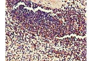 Immunohistochemistry of paraffin-embedded human spleen tissue using ABIN7174759 at dilution of 1:100 (C17orf78 抗体  (AA 1-186))
